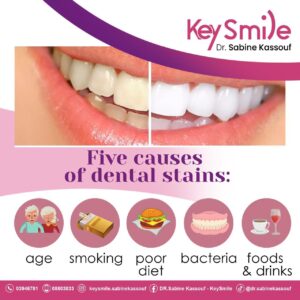 Did you know dental stains have different causes? Keep your smile bright and healthy!